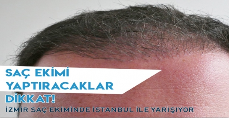 İzmir Saç Ekiminde İstanbul İle Yarışıyor